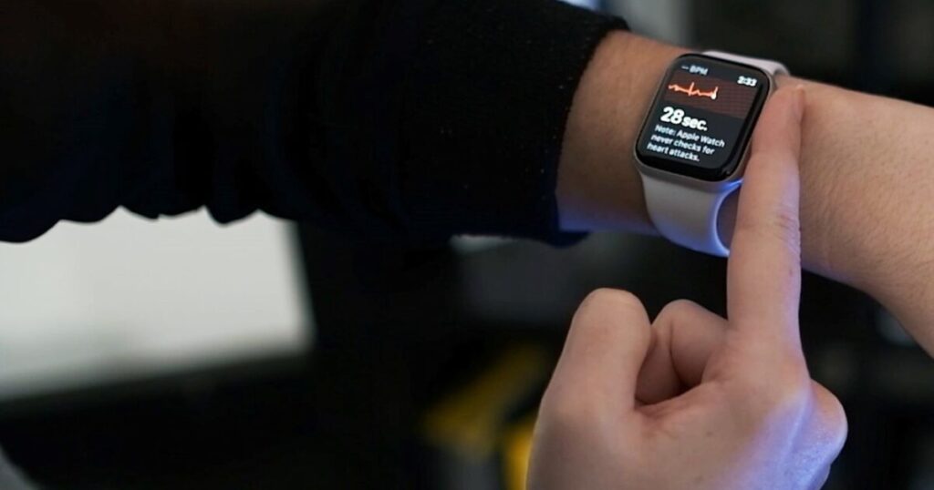 Apple Watch - How to use ECG